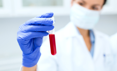 nurse holding test tube clinical lab