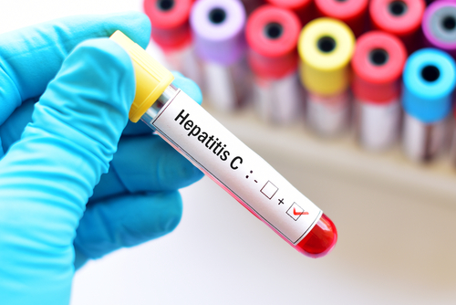 blood sample hepatitis c