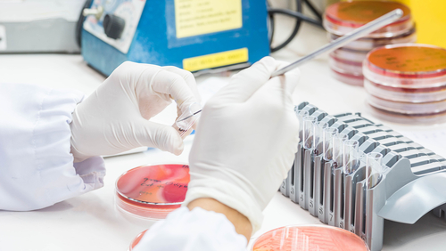 medical technician with bacteria cultures