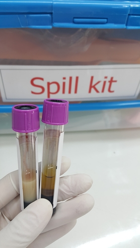 test tubes spill kit